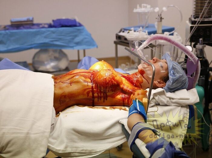 [※ unscrupulous] patients with no awareness of breast implants [new breasts] SNS... 2th image