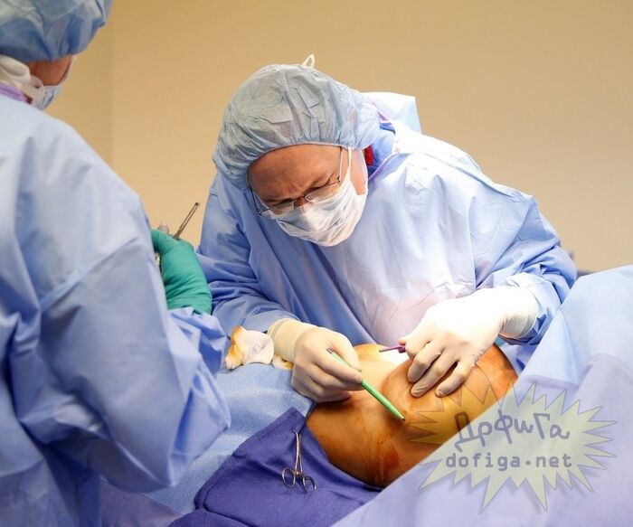 [※ unscrupulous] patients with no awareness of breast implants [new breasts] SNS... 4th image