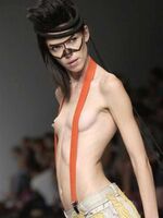 [puzzled] model of the designer's mercy, wwwwwwwwwwwwwww dressed in a ridiculous costume (with images)